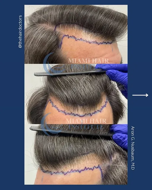 Miami Hair Institute