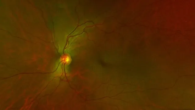 Wilck, Schwartz & Novak OD PC