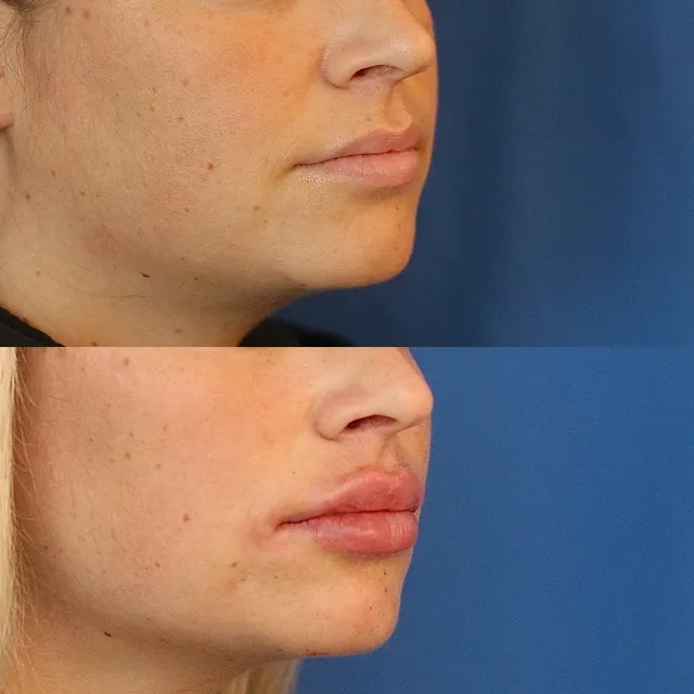 The Kaplan Center for Plastic & Reconstructive Surgery