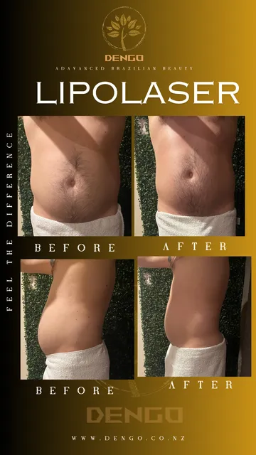 Dengo - Advanced Aesthetics