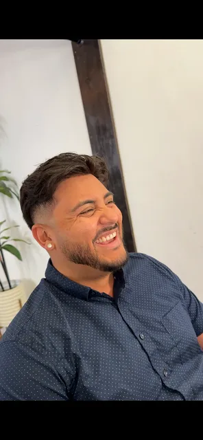 Los Angeles Hair Replacement For Men