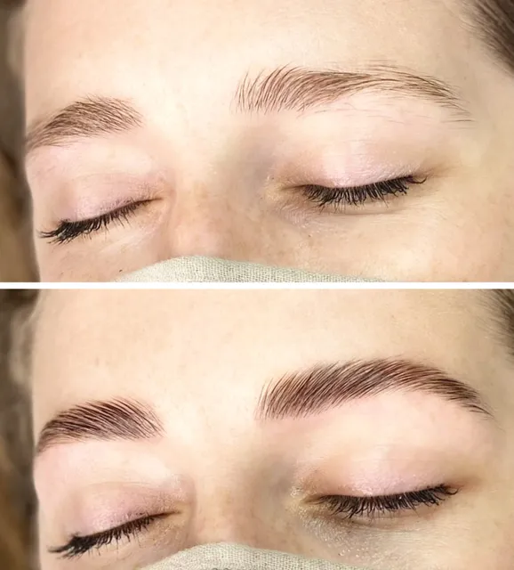 elma healing +esthetics