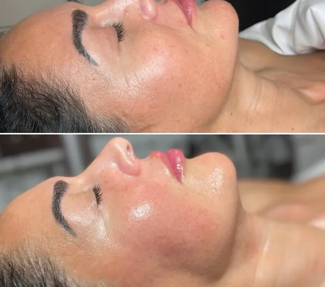 NYC Oasis Buccal/TMJ Spa