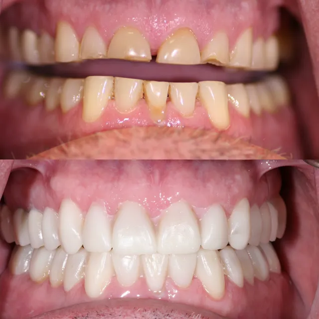 Illume Dental of McKinney