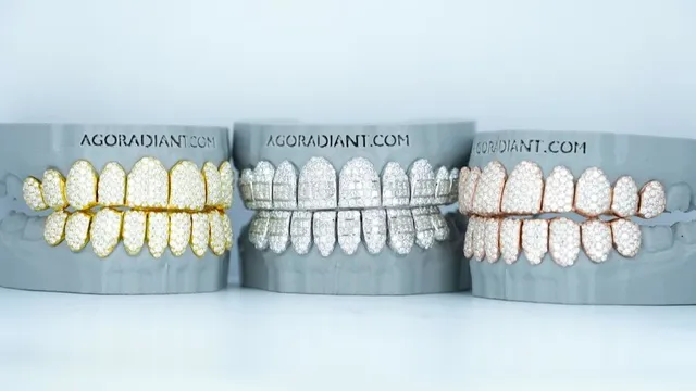 Agoradiant - Diamond Grillz