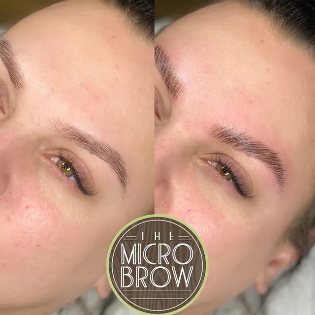 The Micro Clinics - Orlando Microblading and Scalp Micropigmentation Clinic