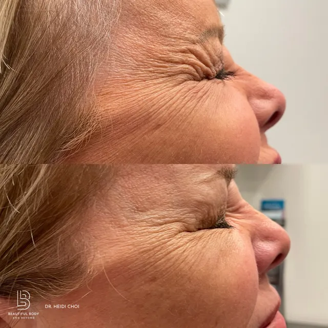 Beautiful Body and Beyond