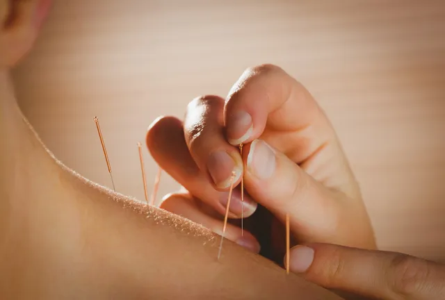 Grace Acupuncture & Oriental Medicine