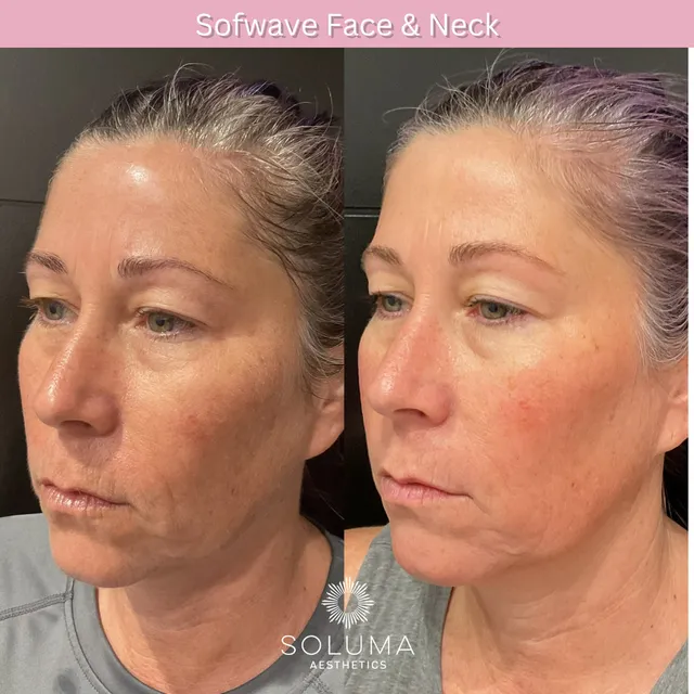 Soluma Aesthetics Med Spa