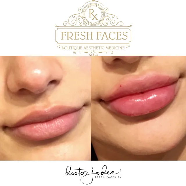 Fresh Faces RX | Advanced Aesthetics in Portland | Dr Jodee M Anderson MD