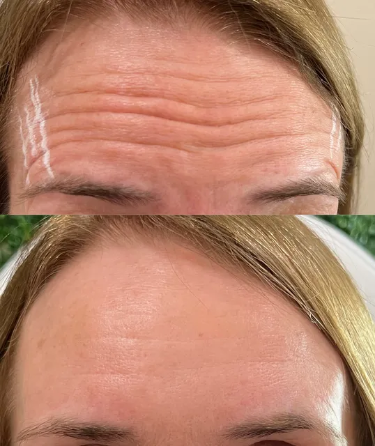 Rejhuvenation Aesthetics