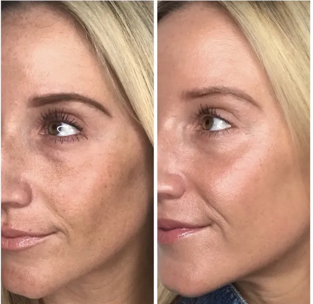 South Florida Face and Body