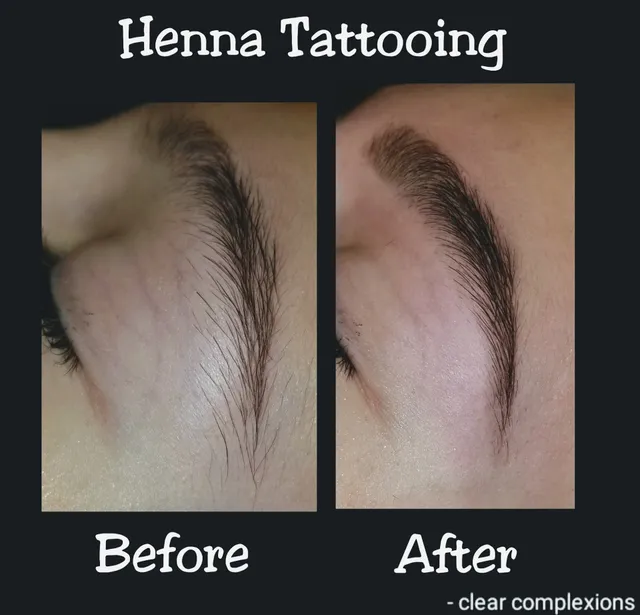 Clear Complexion Skin