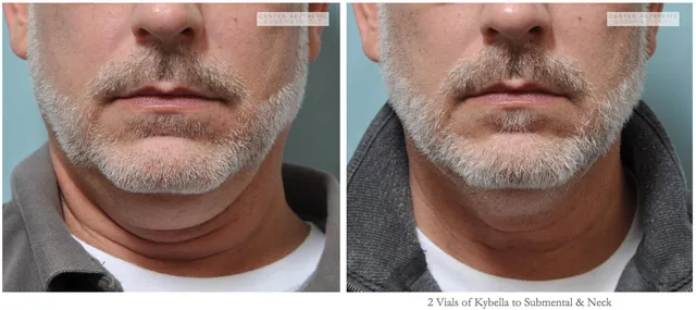 Center Aesthetic & Dermatology