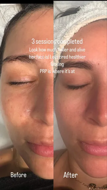 ReJuve Aesthetics Miami