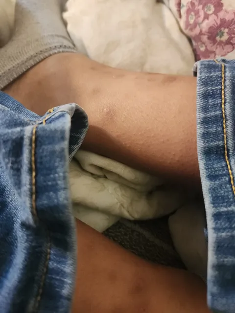 Edwards Treated Woodwork