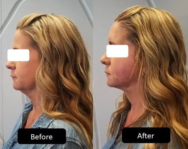 Mark N. Berkowitz, MD