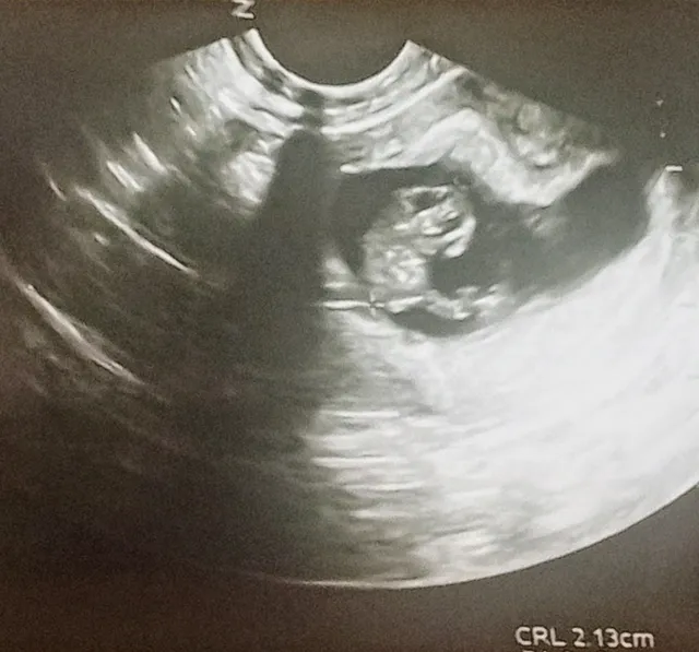 Third Scorpio Designs