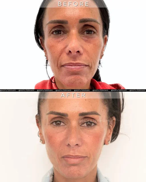 No Filter Medical Spa