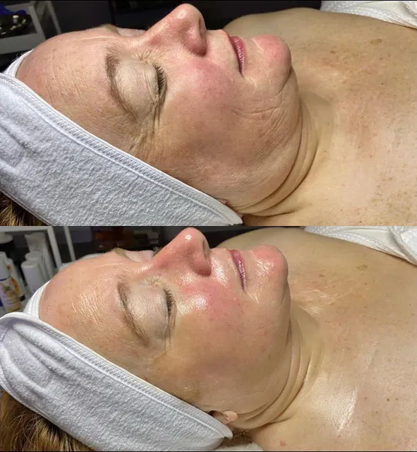 Pure Image Esthetics