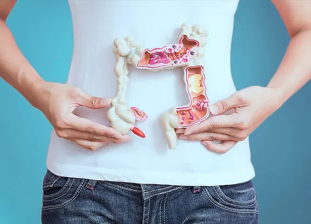 NEAD Health Colon and Pilonidal Clinic & Hemorrhoid Center - Cypress