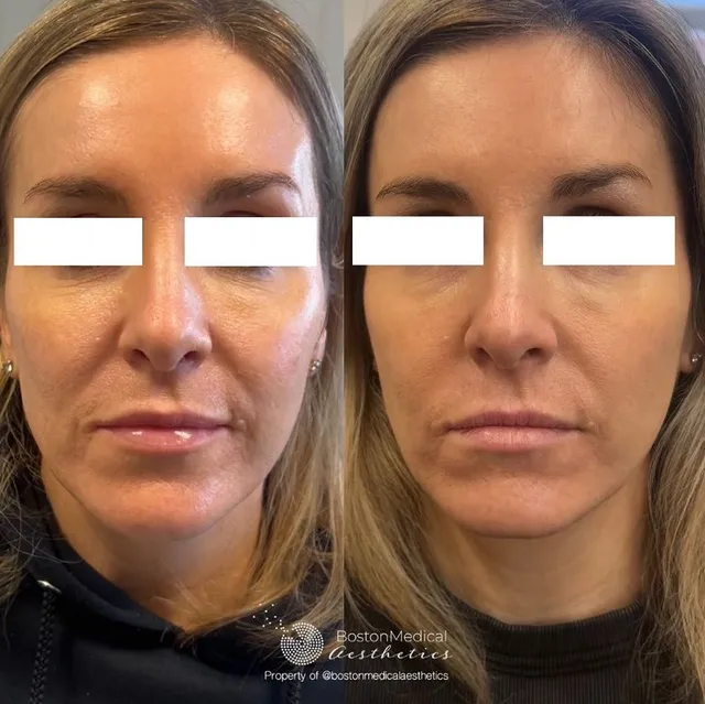 Boston Medical Aesthetics