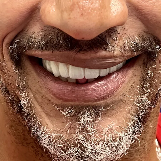 Smile Designers Dental Implant Center