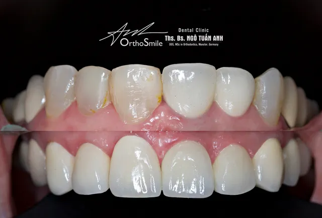 Nha khoa Ths .Bs. Ngô Tuấn Anh