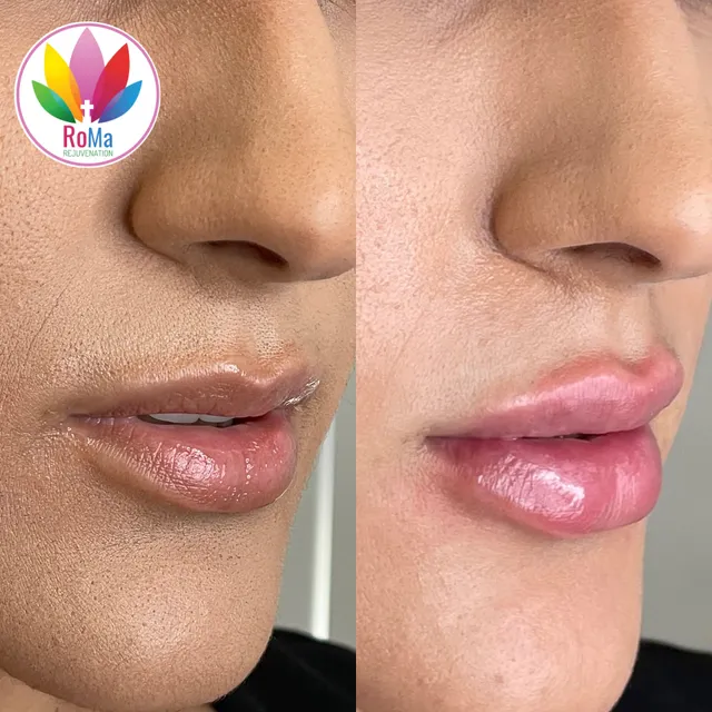 Roma Rejuvenation