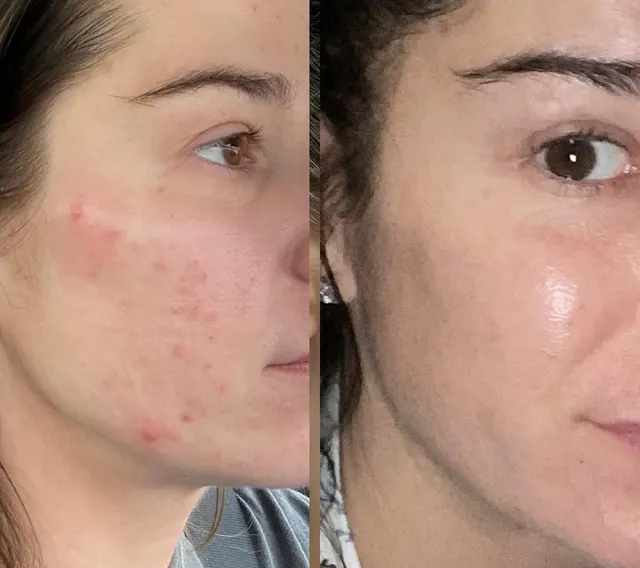 Pelle Sana Facial Spa