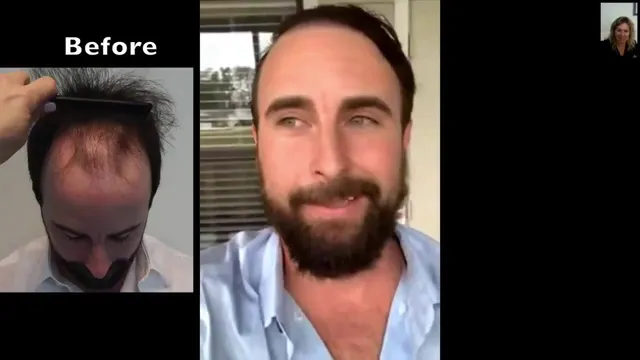 Natural Transplants, Hair Restoration Clinic