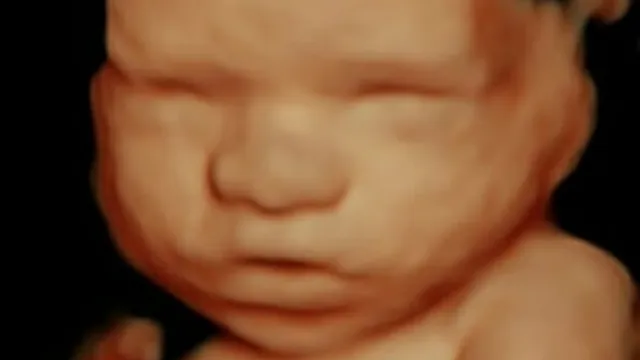 A Little Insight 3D 4D 5D Ultrasound