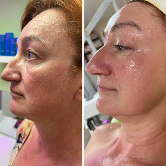 Kiwi Spa Organic Facial Innovation