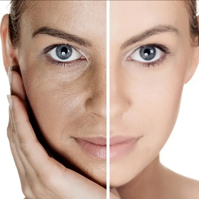 Facelift Lounge2/All About Face