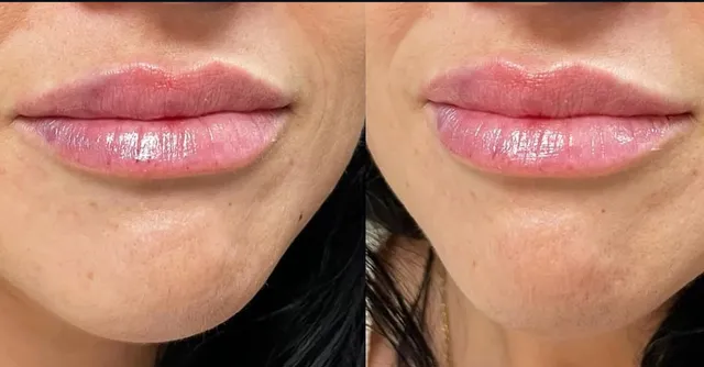 Black Diamond Aesthetics