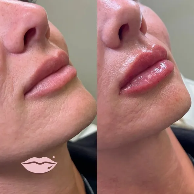 The Beauty Spot MedSpa