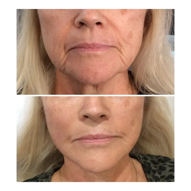 Skin Secrets Fort Lauderdale