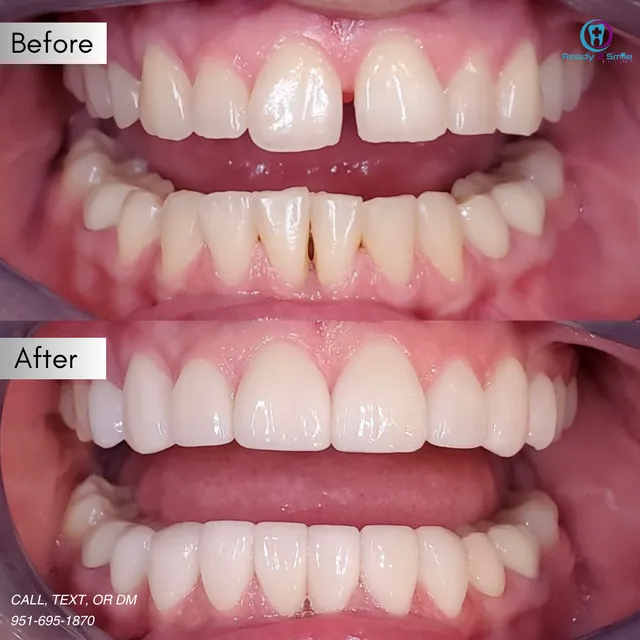 Ready 2 Smile Dental Group