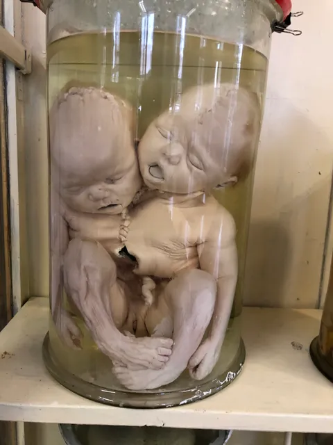 Muzey Khvorob Lyudyny