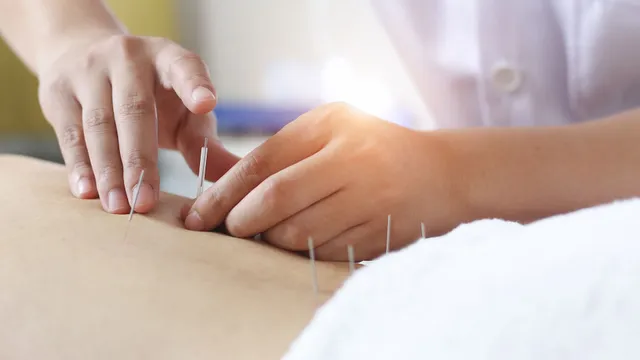Dr. Helen Sun Acupuncture Clinic-best acupuncture cupertino/acupuncture near me/中药店/湾区中医按摩 南湾针灸医生推荐