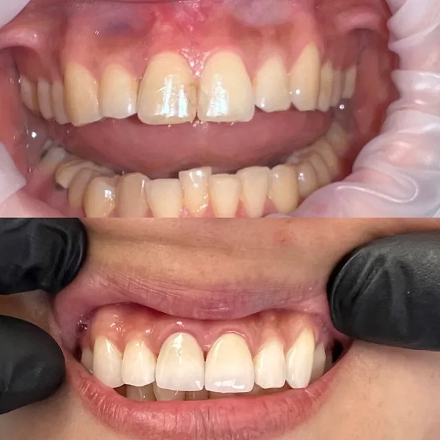 Beverly Grove Dentistry