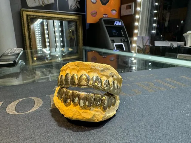 Atlanta Custom Gold Grillz