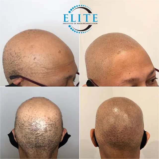 Scalp Masters Atlanta