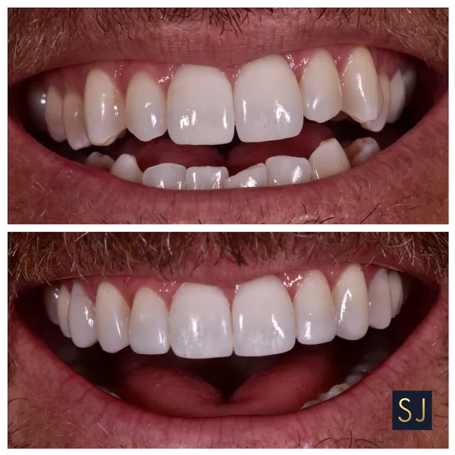 Sarah Jebreil D.D.S. Dental Esthetics