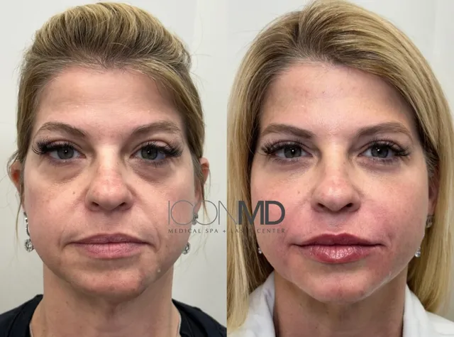 Icon MD Medical Spa + Laser Center Boston