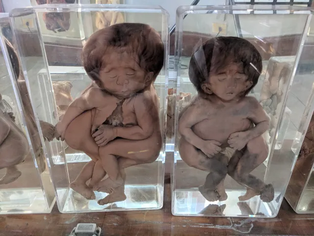 Congdon Anatomical Museum