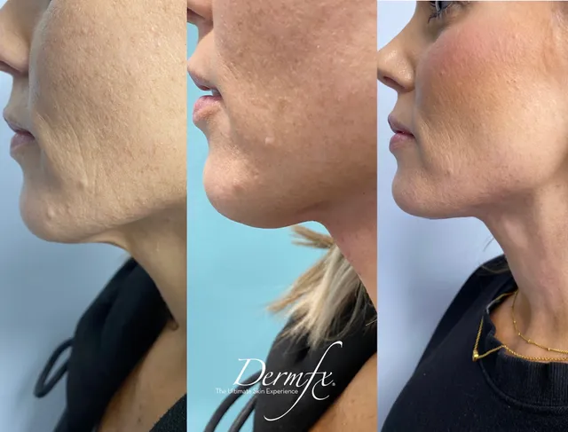 DermFx Redondo Beach