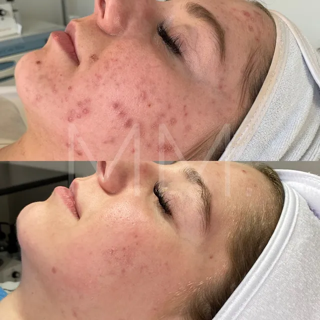 MM SKINCARE + ACNE CLINIC