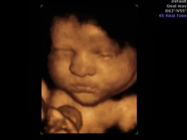 Vegas Baby! 4D Ultrasound