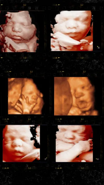 UC Baby 3D Ultrasound